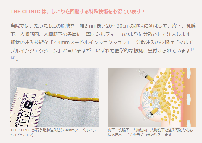 ザ・クリニックしこりを回避する特殊技術画像