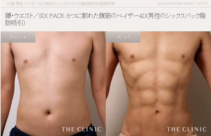 ザ・クリニックベイザー4DXの画像