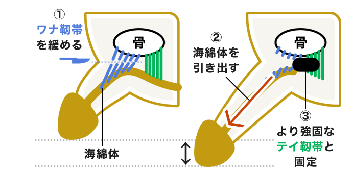 アトムクリニックの切る長茎術