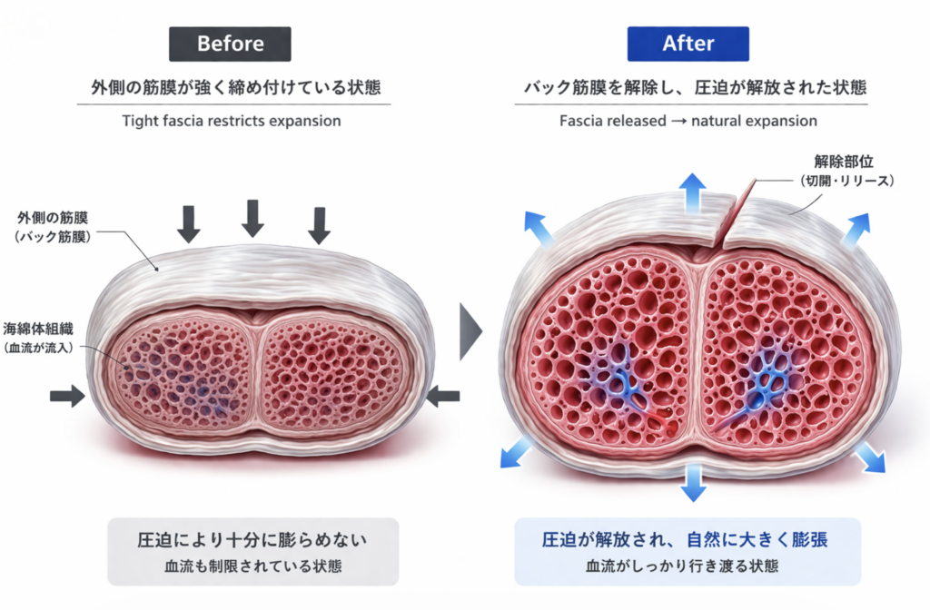 ルーツピーリングの症例写真(イメージイラスト)